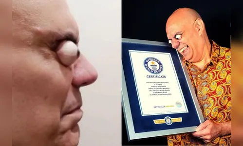 Brasileiro ganha 'título' por ter olhos mais esbugalhados do mundo