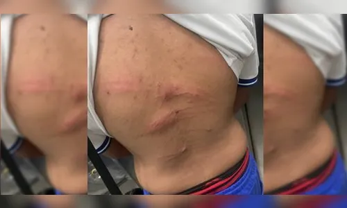 Mãe homofóbica xinga e agride filho de 17 anos a pauladas: 'Demônio'