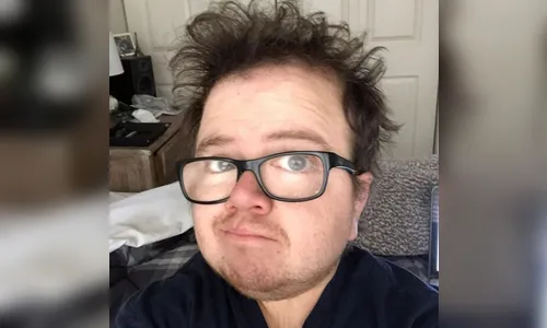 YouTuber portador de doença rara morre aos 27 anos