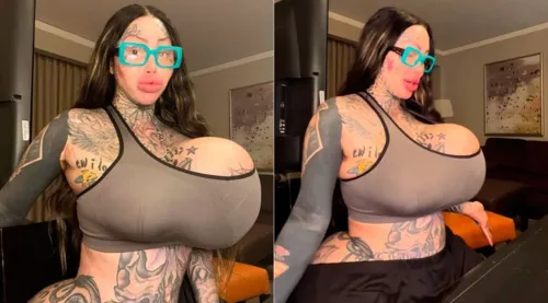 Após o incidente que teve com seu silicone, a modelo canadense disse, através de seus Instagram, que "voltará a ser natural"