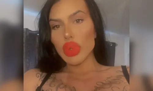 Modelo de site adulto gasta R$1,3 mi para ter maiores lábios do mundo