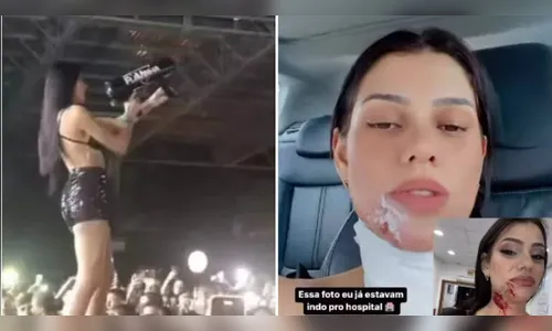 DJ fica ferida após disparar canhão de confetes no próprio rosto; veja