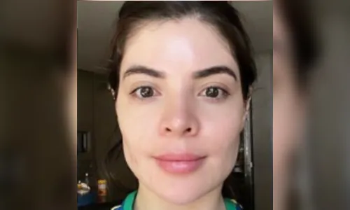 Famosos revertem procedimentos estéticos e se sentem mais bonitos