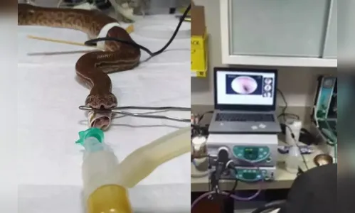 Jiboia passa por endoscopia após problemas alimentares; assista