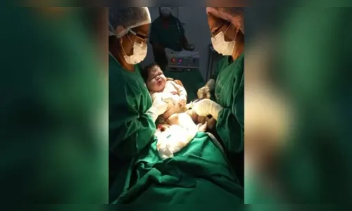 Bebê nasce com mais de 7 kg e bate recorde no Amazonas