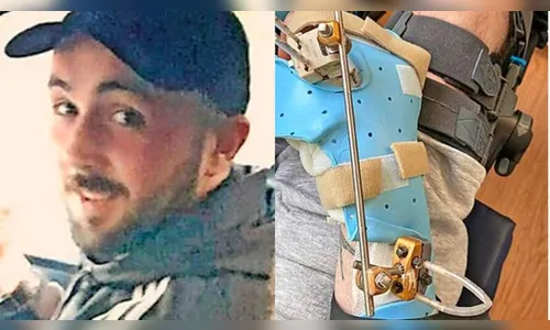 Homem tem mão decepada em ataque brutal de gangue