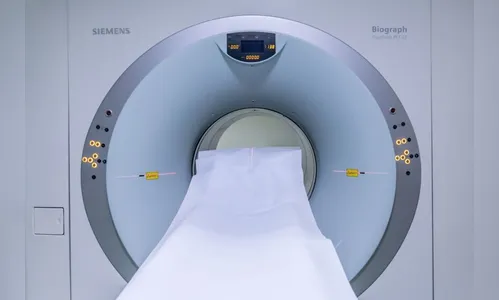 Homem dorme em ressonância magnética e passa a noite em hospital