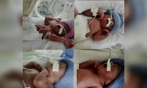 Mulher dá à luz a três meninos e uma menina do Paraná