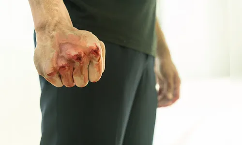 Porteiro de condomínio é agredido a socos por entregador, em Apucarana