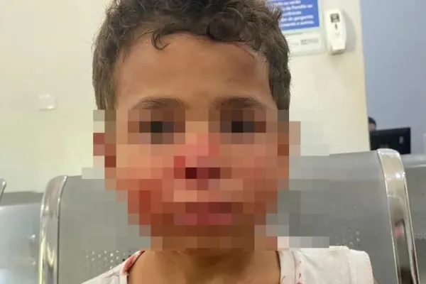 Lucas Santos de Moura estava na sala no momento do ataque. Ele teve ferimentos no nariz e na nuca