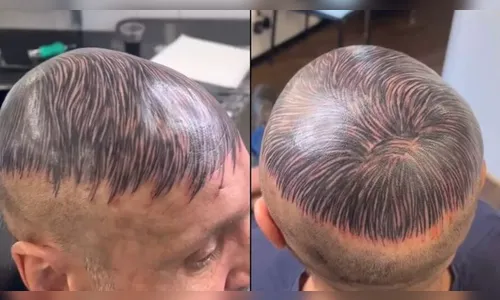 Homem calvo tatua cabelo e viraliza nas redes: 