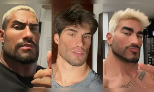 Ex-BBBs ironizam harmonização facial de Fred Nicácio e são criticados