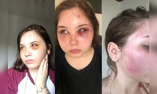 ‘Achei que ia morrer’, diz filha de sertanejo do PR, agredida pelo pai