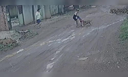 Vídeo: cão foge de residência e ataca criança que passeava com a mãe