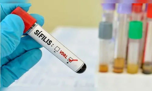 Aumento de casos de sífilis congênita gera alerta na região