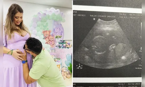 Mulher interrompe gestação ao saber que filho não sobreviveria