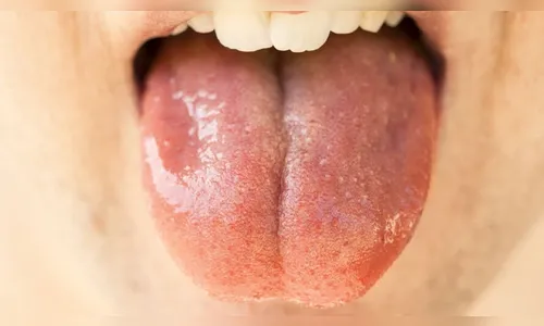 Para se defender, mulher morde e arranca língua de estuprador