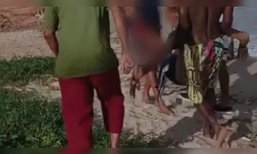 Vídeo: surfista é internado em estado grave após ataque de tubarão