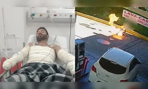 Ministério Público denuncia frentista que ateou fogo em cliente no PR