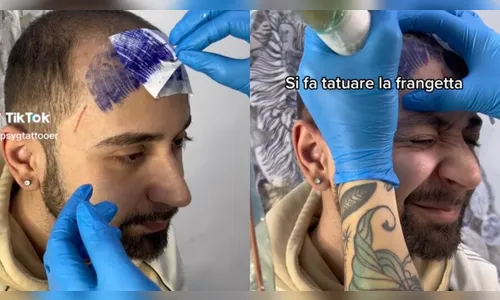 Vídeo de homem careca chorando após tatuar franja na testa viraliza