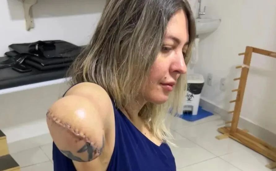 A tatuadora Camila Gama, de 41 anos, viu o sonho da cirurgia plástica se tornar pesadelo