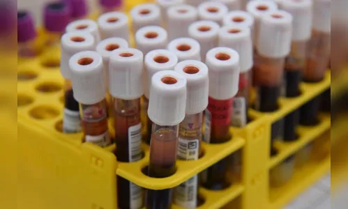 Junho Vermelho: Saúde do PR reforça importância da doação de sangue