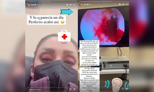 Cantora Anahí, do RBD, tem tímpano perfurado ao fazer molde de fone