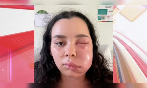Jovem é internada após contrair infecção ao retirar sisos; vídeo