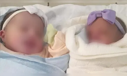 Mulher dá à luz gêmeas sem saber de gravidez e uma delas cai no vaso