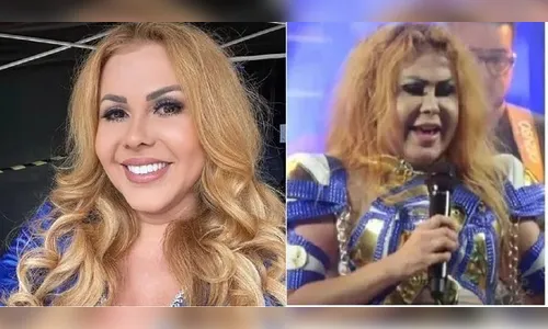 Fim de mistério! Joelma recebe diagnóstico médico após inúmeros exames