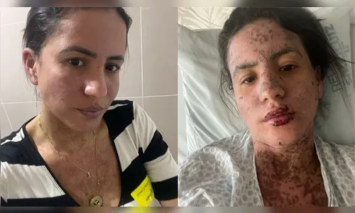 Conheça a doença rara que deixou a esposa de Frank Aguiar na UTI