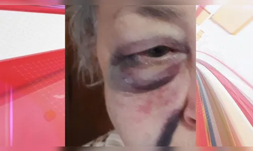 Agressão à idosa em tentativa de roubo gera indignação em Apucarana