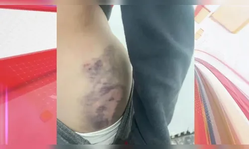 Padrasto diz na polícia que bateu em menino de 8 anos para “educar”