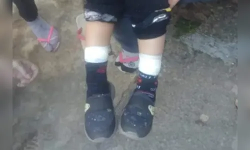 Criança de 2 anos tem pernas presas com fita crepe em creche