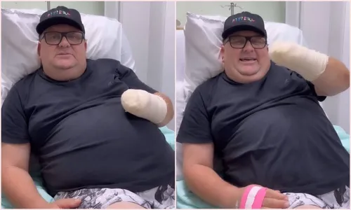 Humorista perde a mão em acidente com foguete: 'Vida que segue'