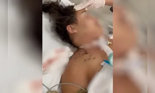 Mulher perde bebê após levar 20 facadas da ex do namorado