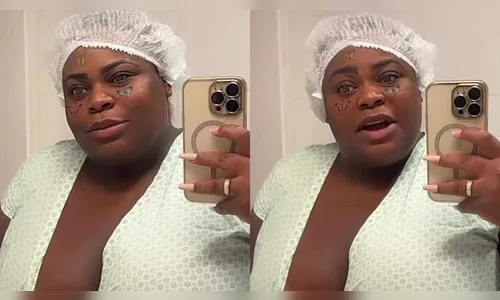 Cantora Jojo Todynho faz cirurgia bariátrica: ''Tô ótima''