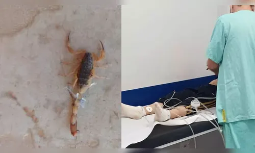 Criança de 9 anos é picada por escorpião ao calçar tênis em Maringá