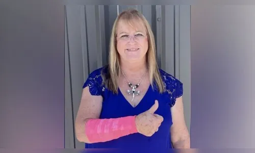 Mulher fica ferida ao sofrer ataque simultâneo de falcão e cobra