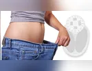 Responsabilidade no custeio da cirurgia plástica após a bariátrica