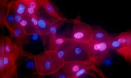 Número de casos de câncer entre jovens tem aumento de 79% em 30 anos