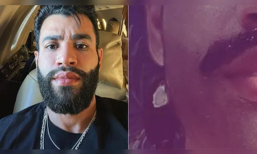 Gusttavo Lima choca ao aparecer sem barba e só de bigode