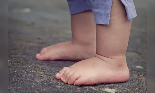 Criança sofre queimaduras graves no corpo em CMEI de Arapongas