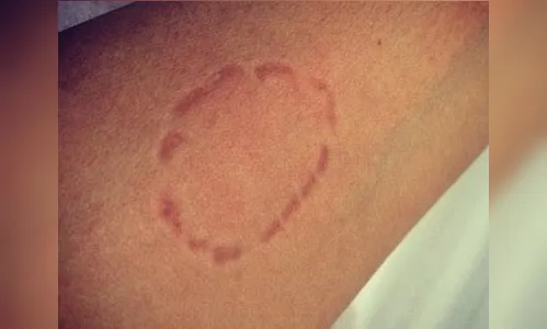 Filha bêbada pede abraço, enforca pai e morde tornozelo do idoso no PR