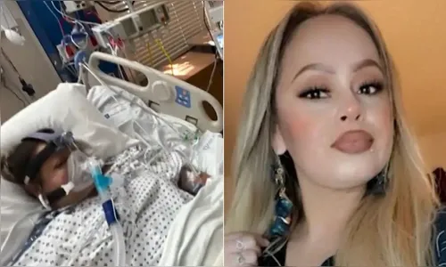 Mulher perde braços e pernas após comer tilápia; entenda o que houve