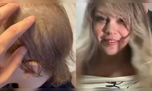 Simony exibe novo visual após tratamento contra câncer