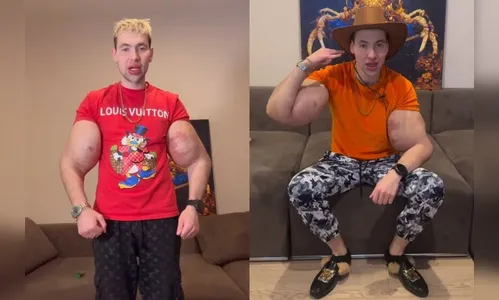 “Popeye russo” procura namorada “sem celulite e sem cheiro de caspa”