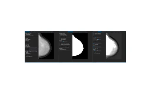 Software desenvolvido na UEL avalia progressão do câncer de mama