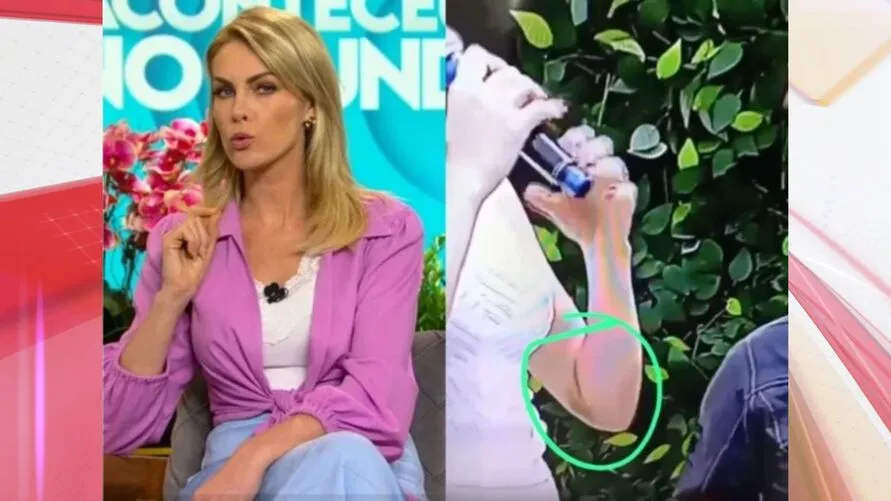 Vestido deixa à mostra o hematoma em seu braço.