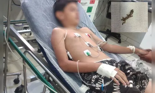 Mãe do menino que comeu lagartixa diz que filho ainda tem sequelas